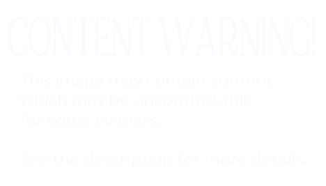 Content Warning